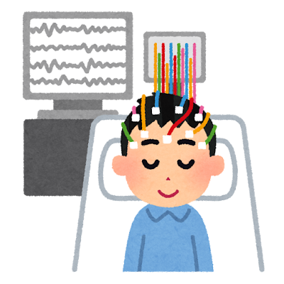 てんかんのイラストです