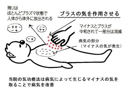 気功療法のメカニズム イメージ